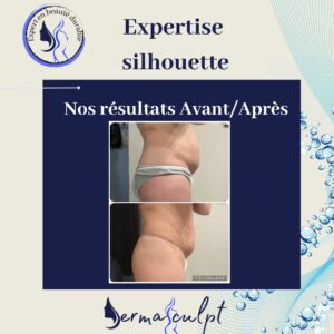 minceur silhouette ventre